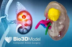 Articolo_Stampa_3D_Medicina