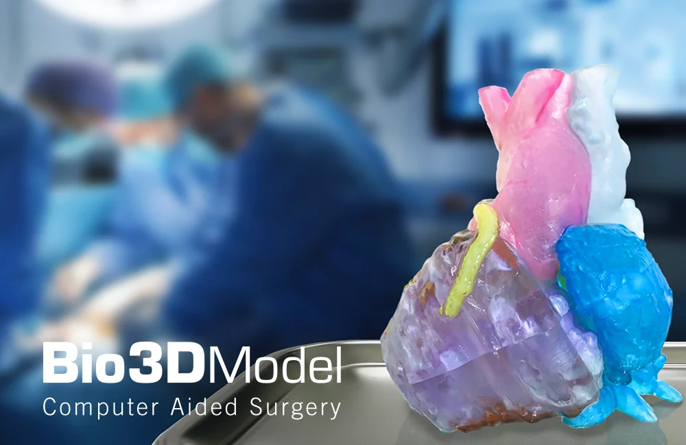 Articolo_Stampa_3D_in_clinica